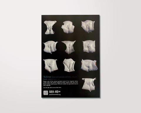 Plakat: Vulven Vielfalt