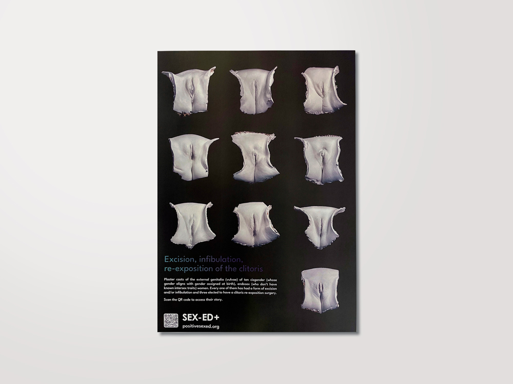 Plakat: Genitalverstümmelung Vulva 