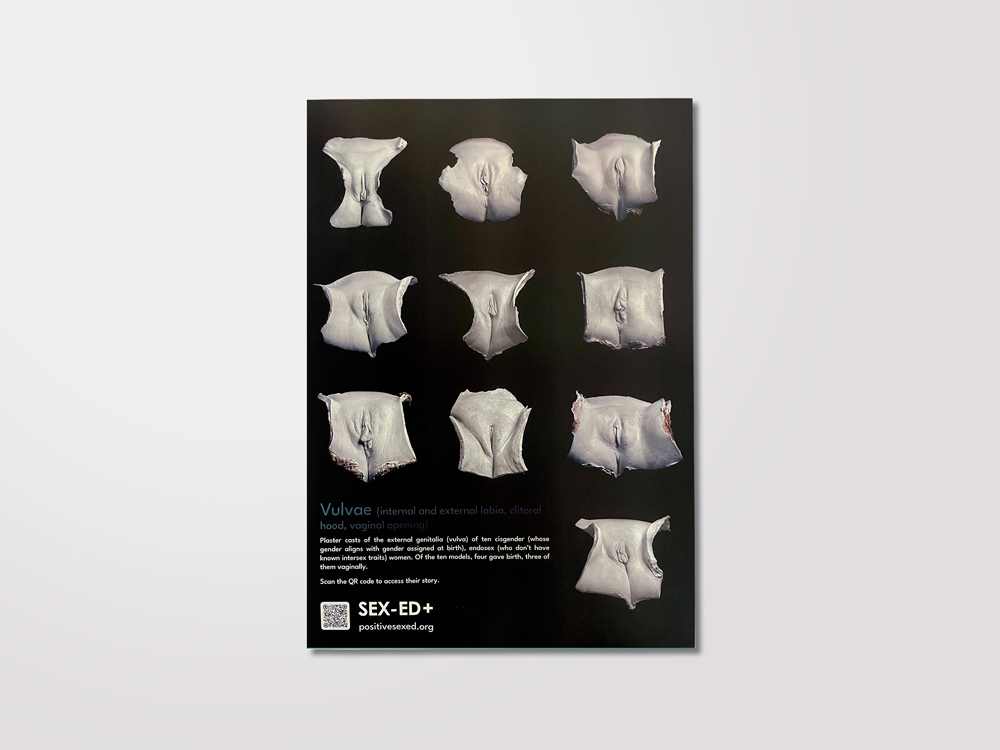 Poster: Varietà di Vulva 